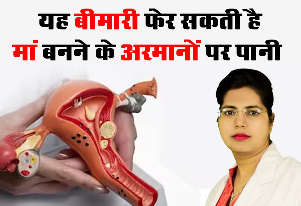 Uterine Cyst Disease : यह बीमारी फेर सकती है मां बनने के अरमानों पर पानी, यह सावधानी बरतना जरूरी : डॉ. चंचल शर्मा
