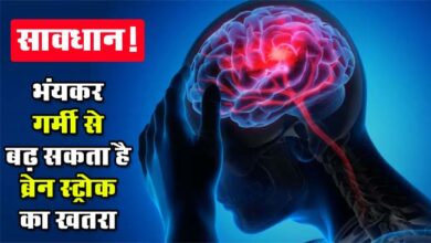Brain Stroke: सावधान! भंयकर गर्मी से बढ़ सकता है ब्रेन स्ट्रोक का खतरा, डॉक्टरों ने चेतावनी दी